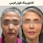 کلینیک پزشکی و زیبایی آریاناز/پونک
