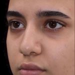 کلینیک زیبایی الماس کاملا اقساطی
