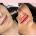 کلینیک پوست و زیبایی ژیلاوَش