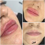 کلینیک زیبایی مون بیوتی