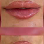 کلینیک پوست،مو،زیبایی و لیزر دالیا
