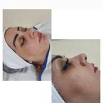 فیشال تخصصی و کلاسیک پوست نیکناز