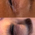 خدمات تخصصی پوست،فیشال،ماساژ سندی بانوان