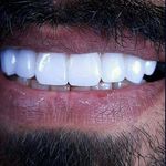 دکترای پروتزهای دندانی اکبری
