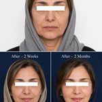 مرکز تخصصی زیبایی و لیزر دمور