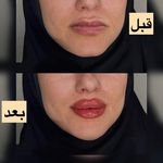 کلینیک پوست،زیبایی و لیزرماریسا