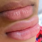 مرکز تخصصی میکروبلیدینگ مینا