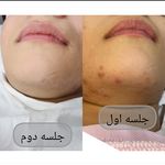 کلینیک تخصصی پوست ملینا