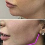 کلینیک زیبایی ولیزر میفا