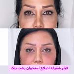 مرکز لیزر و کلینیک زیبایی پریفا