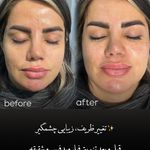 مرکز لیزر و کلینیک زیبایی پریفا