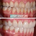 مركز دندانپزشکی دکترفرنوش عیوضی