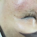 سالن تخصصی پاکسازی پوست هما