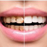 بیمه دندانپزشکی نوین سلامت