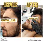 مرکز زیبایی,بوتاکس و لیزر آروشا