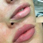 کلینیک پوست و زیبایی ری‌ماه