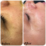 خدمات تخصصی فیشال سارا اسکین بار