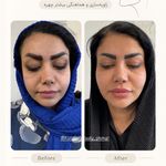 مرکز لیزر ،پوست و زیبایی کندی بیوتی