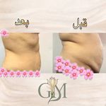 مرکز تخصصی لاغری گل مریم