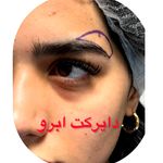 کلینیک زیبایی دریا/دکتر امیر قهرمانی