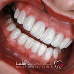 کلینیک دندانپزشکی هلسا(اقساط)