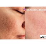مرکز لیزر و زیبایی دکتر رسولی