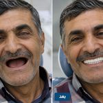 دندانسازی لبخند