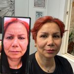 مطب پوست و مو و لیزر ژیوان