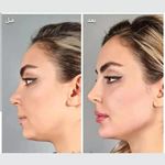 کلینیک پوست و زیبایی ژیلاوَش