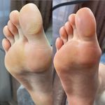 خدمات تخصصی پدیکور درمانی شیوا