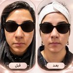 مرکز لیرز و جوانسازی پوست شهربانو