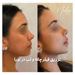 کلینیک زیبایی و لیزر مو زائد نوبا