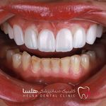 کلینیک دندانپزشکی هلسا(اقساط)