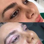 فیشال درمانی و پاکسازی پوست میرجلیلی