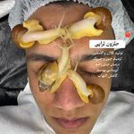 پاکسازی پوست و فیشیال تخصصی آقایان