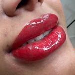 میکرو فیبروز هشتگرد بیتا