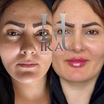 کلینیک زیبایی و لیزر هیرا