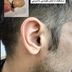 سمعک و شنوایی سنجی هما