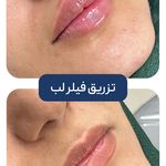 کلینیک زیبایی و جوانسازی پوست و مو الین