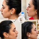 کلینیک پوست مو زیبایی  آیسان امیدی(وتنم)