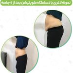 کلینیک لاغری تخصصی باربی شو