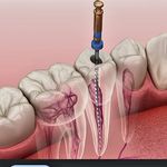 دندانپزشکی و دندانسازی مروارید