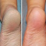 خدمات تخصصی پدیکور درمانی شیوا
