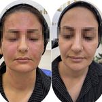 کلینیک تخصصی ژل و بوتاکس مرضیه آقابابایی