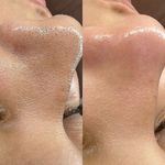 خدمات تخصصی هیدرو فیشال صورت نومه لوکس