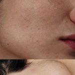 فیشیال / خدمات پوست / سالن زیبایی