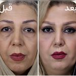 کلینیک زیبایی الماس کاملا اقساطی