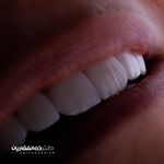 دندانپزشکی زیبایی دکتر ذوالفقاریان