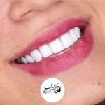 کلینیک دندان پزشکی و ایمپلنت الیسو