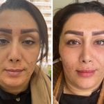کلینیک زیبایی مهر دخت آتوسا
